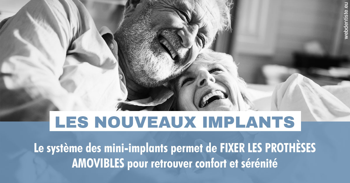 https://dr-strube-nicolas.chirurgiens-dentistes.fr/Les nouveaux implants 2