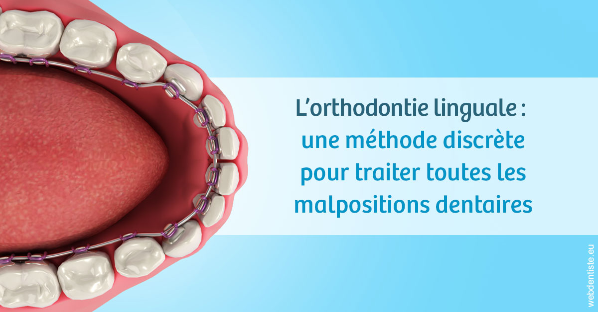 https://dr-strube-nicolas.chirurgiens-dentistes.fr/L'orthodontie linguale 1
