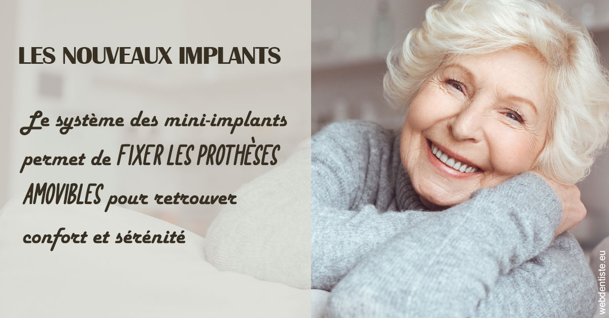 https://dr-strube-nicolas.chirurgiens-dentistes.fr/Les nouveaux implants 1