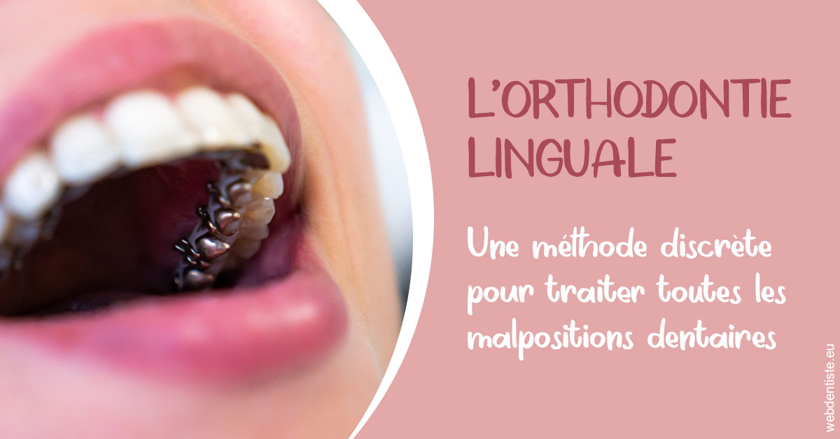 https://dr-strube-nicolas.chirurgiens-dentistes.fr/L'orthodontie linguale 2