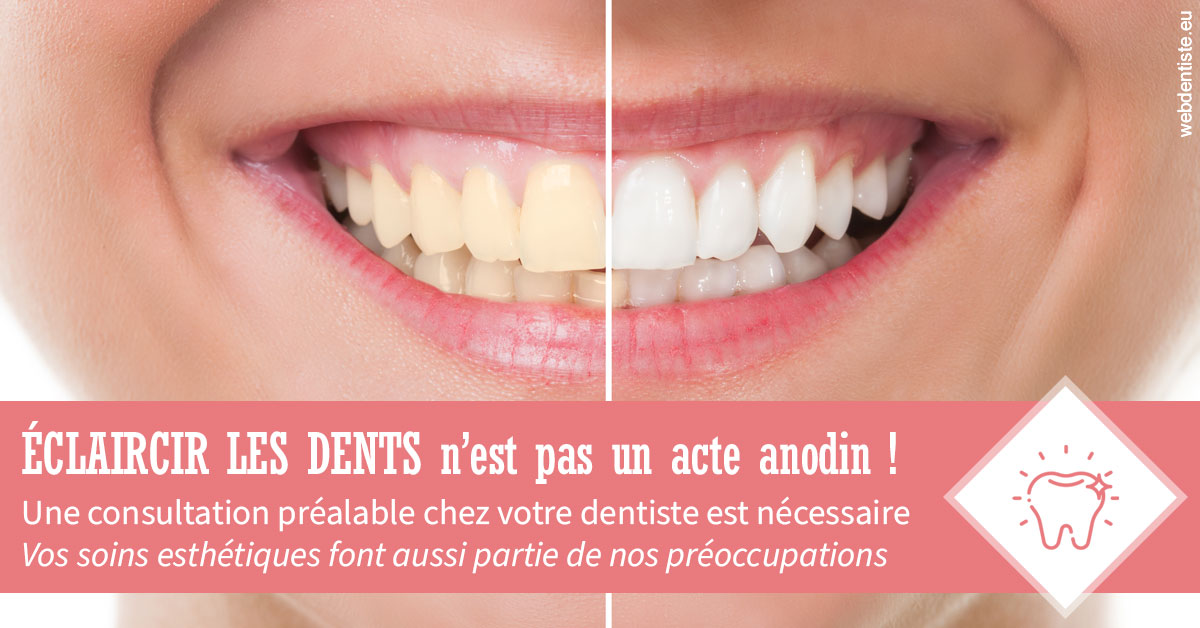 https://dr-strube-nicolas.chirurgiens-dentistes.fr/Eclaircir les dents 1