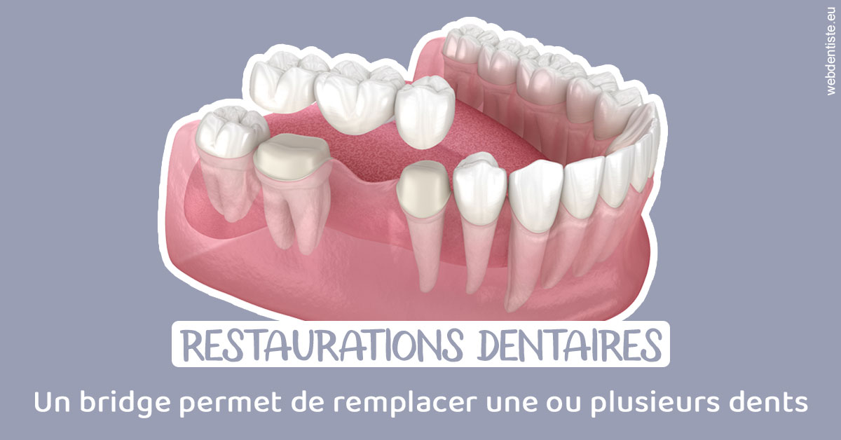 https://dr-strube-nicolas.chirurgiens-dentistes.fr/Bridge remplacer dents 1