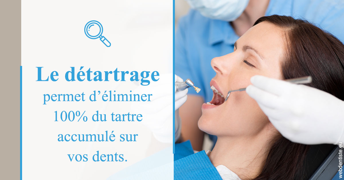 https://dr-strube-nicolas.chirurgiens-dentistes.fr/En quoi consiste le détartrage