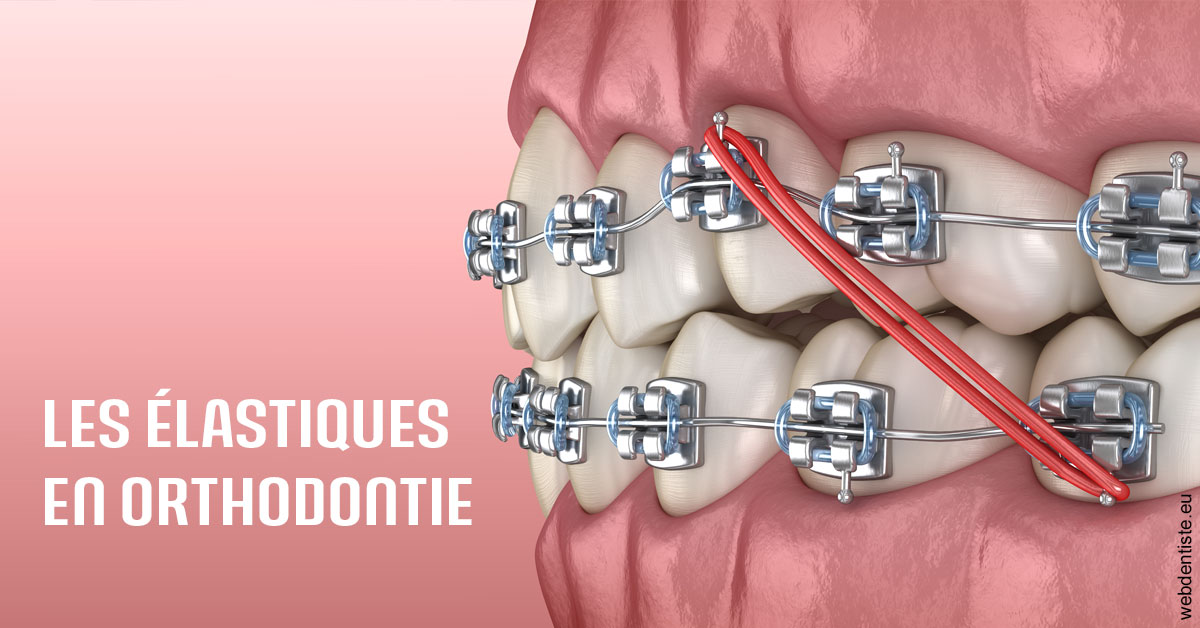 https://dr-strube-nicolas.chirurgiens-dentistes.fr/Elastiques orthodontie 2