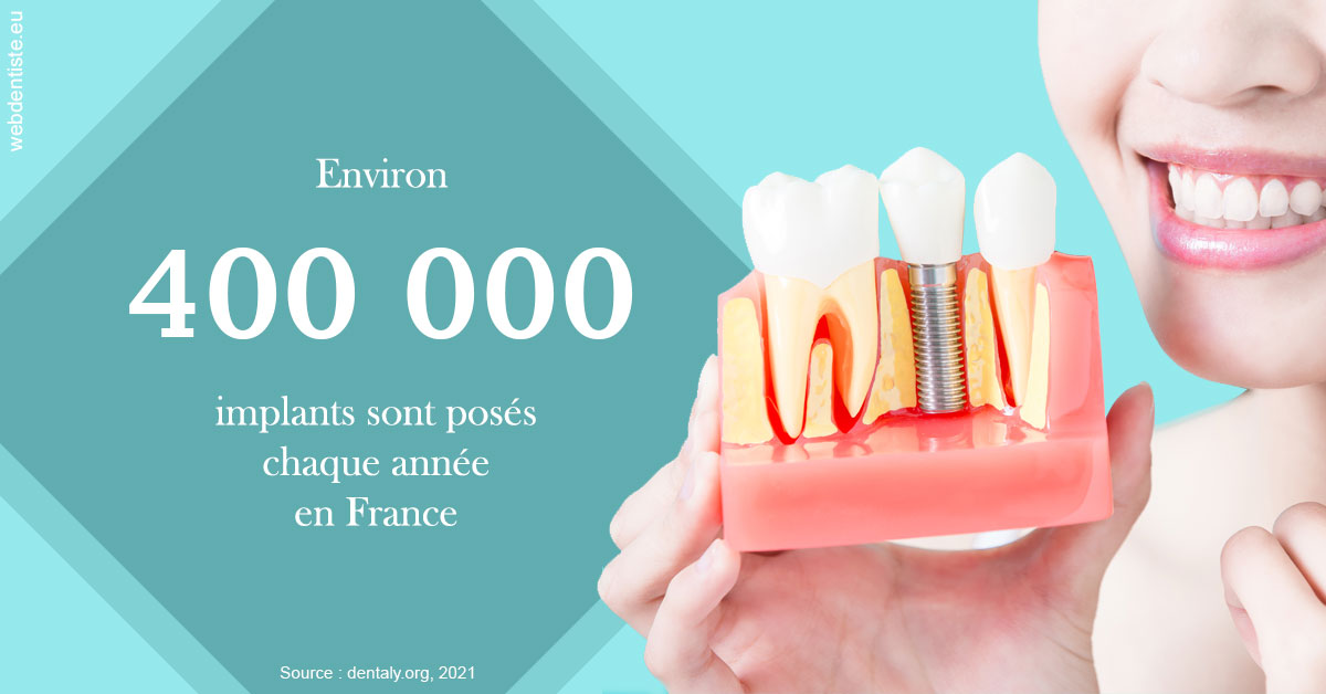 https://dr-strube-nicolas.chirurgiens-dentistes.fr/Pose d'implants en France 2